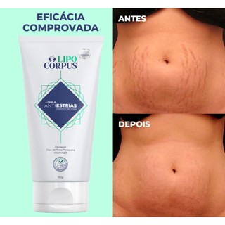 Creme para Estrias Lipo Corpus 1 Unidade - Envio Rápido