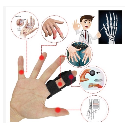 Tala De Dedo Proteção Fraturas Dor Lesão Ajustável Alívio Da Dor Profissional Disparador De Dedos em Oferta na Shopee