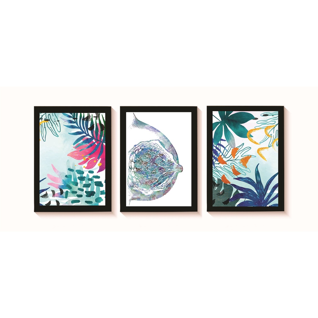Kit 3 Quadros Decorativos Autoexame da Mama Ginecologia Medicina Consultório Molduras 20x30cm Madeira