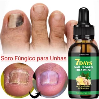 cuidado com UNHAS fungos ovicose micose (1)