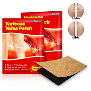 Kit 06 Adesivos Auxilia As Varizes, Vasos E Veias Diminuição