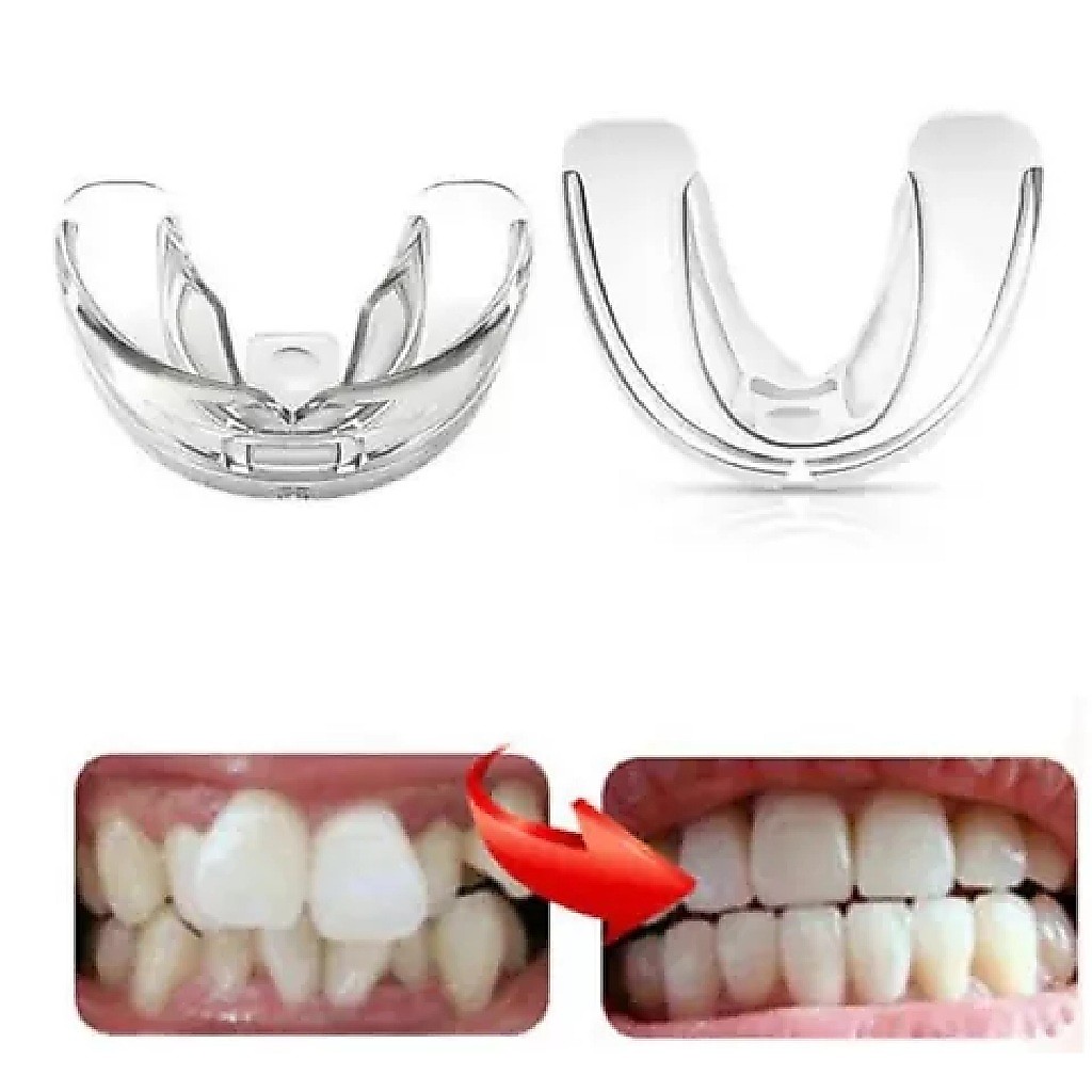 Placa Bucal Anti Ronco anti Bruxismo ajuda a Alinhar os Dentes Aparelho bucal. — imagem 2 de 2