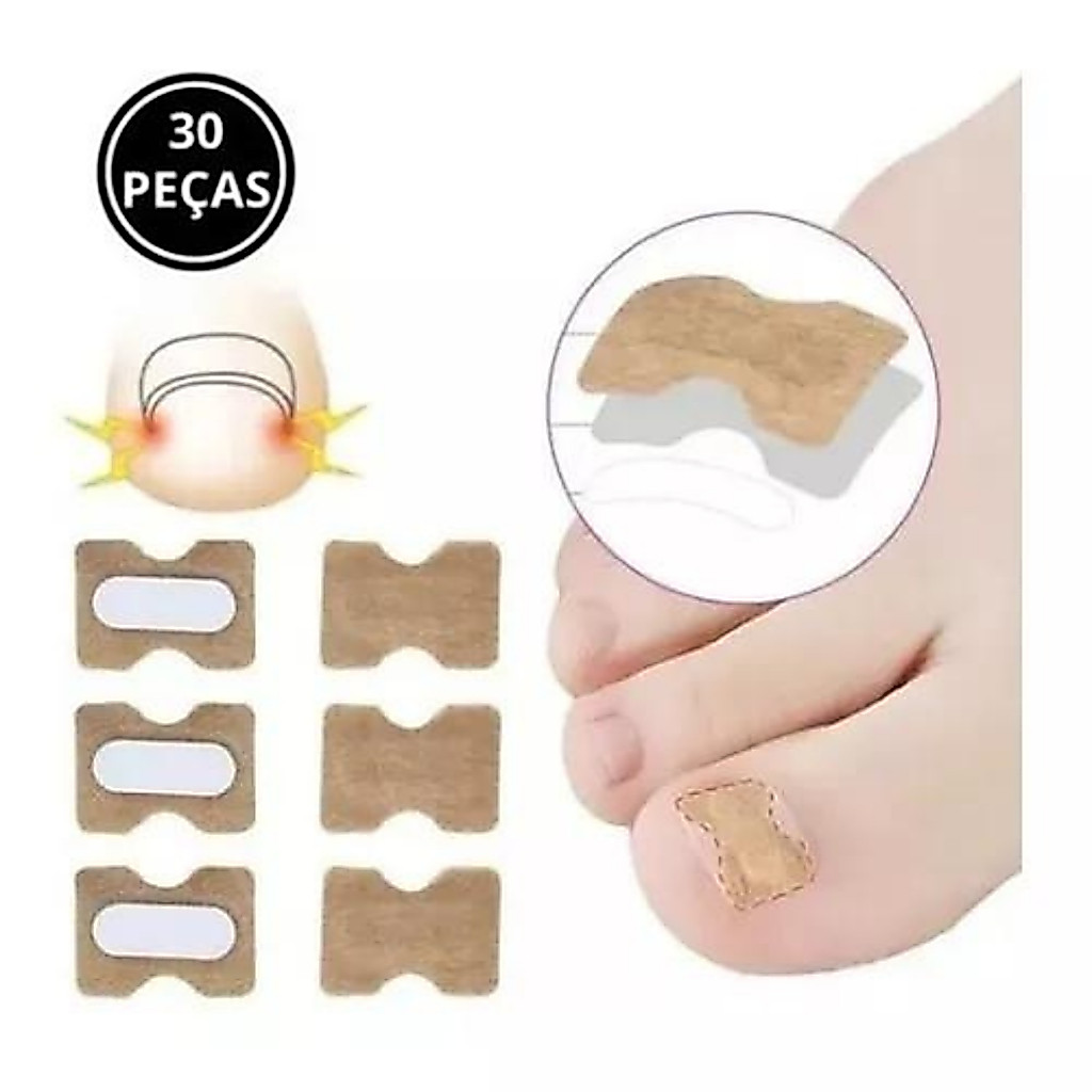 Kit 30 Adesivos Órtose Correção Unha Encravada Saúde Dedo