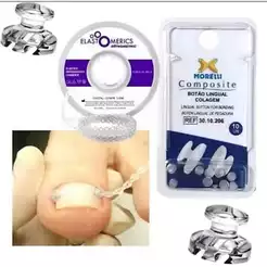 Kit Botão Transparente unha encravada + Elástico Corrente Transparente 30 Centímetro Unha Encravada - Correção