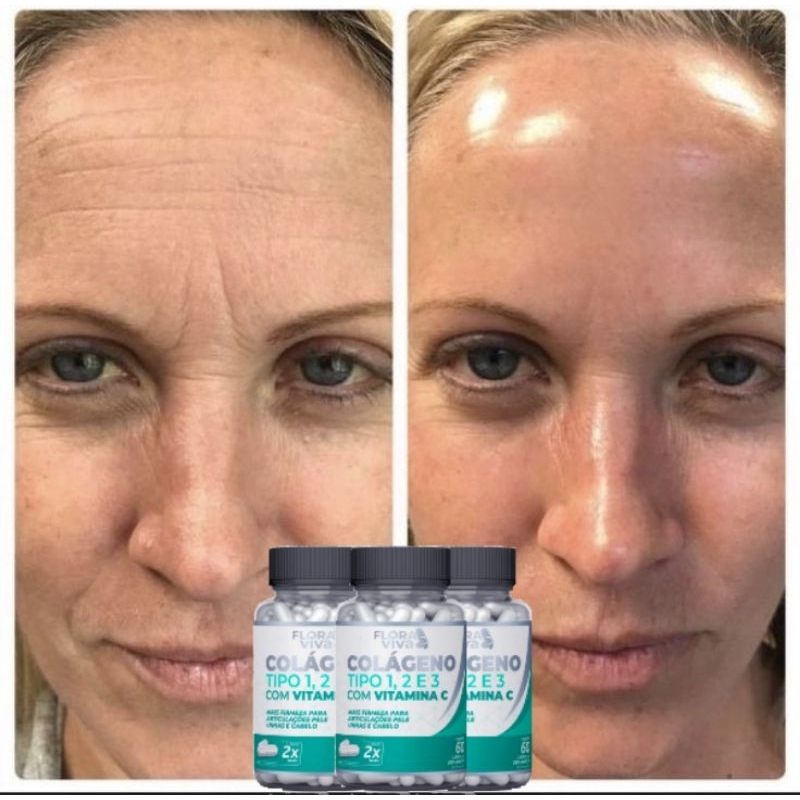 Colágeno Tipo 123 Com Vitamina C Todos em 1 60 Cápsulas 500mg
