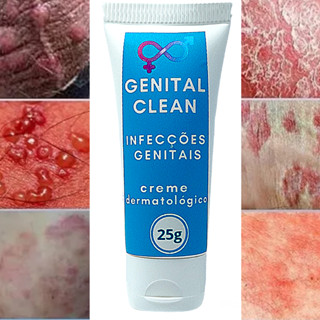 Coçeira na va feminina Pomada
