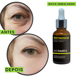 Sérum Retinonew Retinol Ativo Atua Na Redução De Rugas