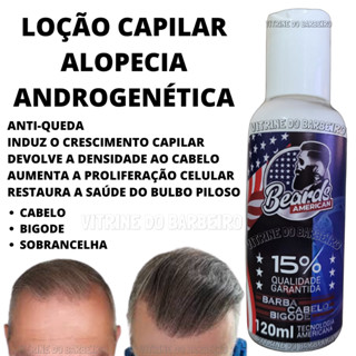 Loção Original Nasce Cresce E Fortalece O Bulbo Capilar Top!