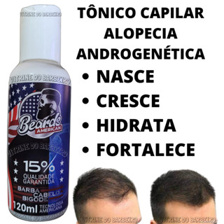 Loção P/ Calvície Careca Nasce Cresce Cabelo Barba Original!