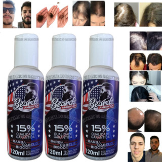 Kit Loção Capilar 6 meses Nasce Cabelo Cura Calvície Masculina Feminina