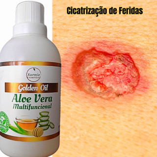 Óleo de Aloe Vera Babosa para Cicatrização Rápida de Feridas 100ml Natural