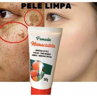 Pomada Mamacadela 50g Original manchas pele limpa pano branco vitiligo em Oferta na Shopee
