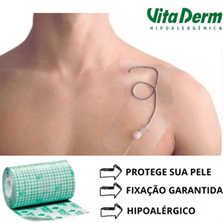 Curativo Filme Protetor De Pele Rolo Transparente Não Estéril Para Fixação 10cm x 3m - Vital Derme ORIGINAL