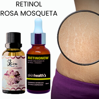 Óleo De Rosa Mosqueta + Sérum Retinol Com Vitamina C - Com NF - Regeneração Celular Em Estrias Clareamento E Antirrugas E Linhas De Expressão