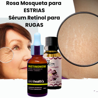 Óleo De Rosa Mosqueta + Retinol Com Vitamina C - Com NF - Regeneração Celular Clareamento De Manchas Antirrugas E Linhas De Expressão