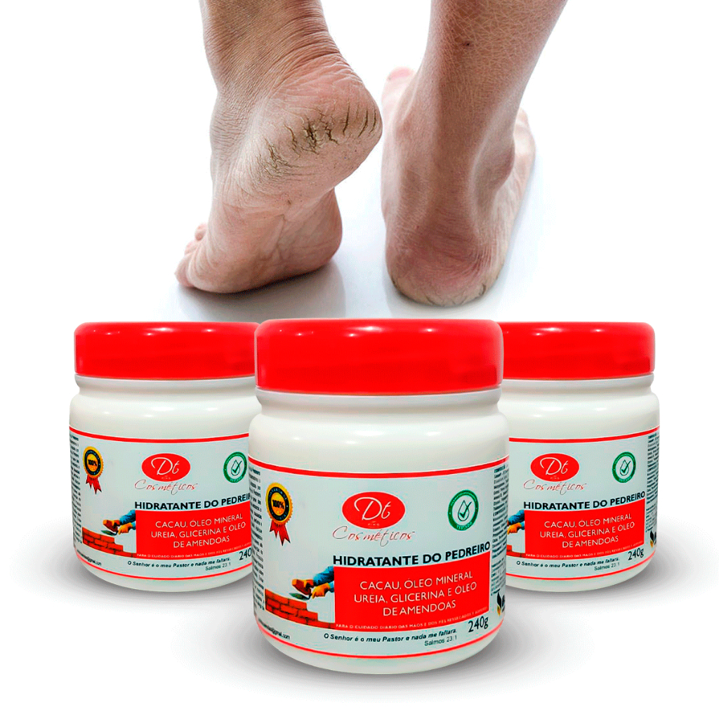 Creme Para Pedreiros 240g - Rachadura Nos Pés