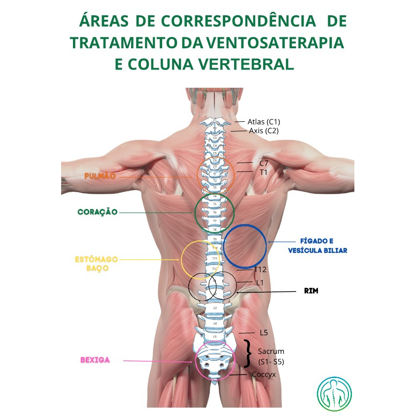 Mapa Ventosaterapia A4 Áreas Correspondente Tratamento E Coluna Vertebral Regiões Plastificado