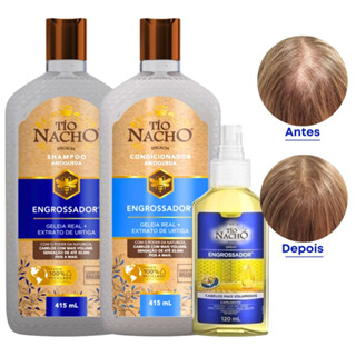 Kit Shampoo Engrossador 415ml + Condicionador Engrossador 415ml + Spray Engrossador Antiqueda 120ml Tio Nacho [Encorpa e engrossa os fios] Reduz a queda e dá mais volume