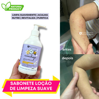 Sabonete Loção De Limpeza Suave 250ml [dermatite Controlada]