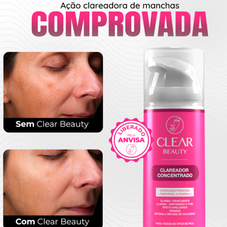 Clear Beauty | Clareador de manchas, melasma e acne para todos tipos de pele 1 Unidade - Envio Rápido