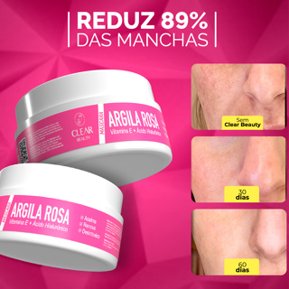 Máscara Facial Clear Beuty com Argila Rosa + Ácido Hialurônico Reduz Acne e Marcas de Cicatriz - 90g