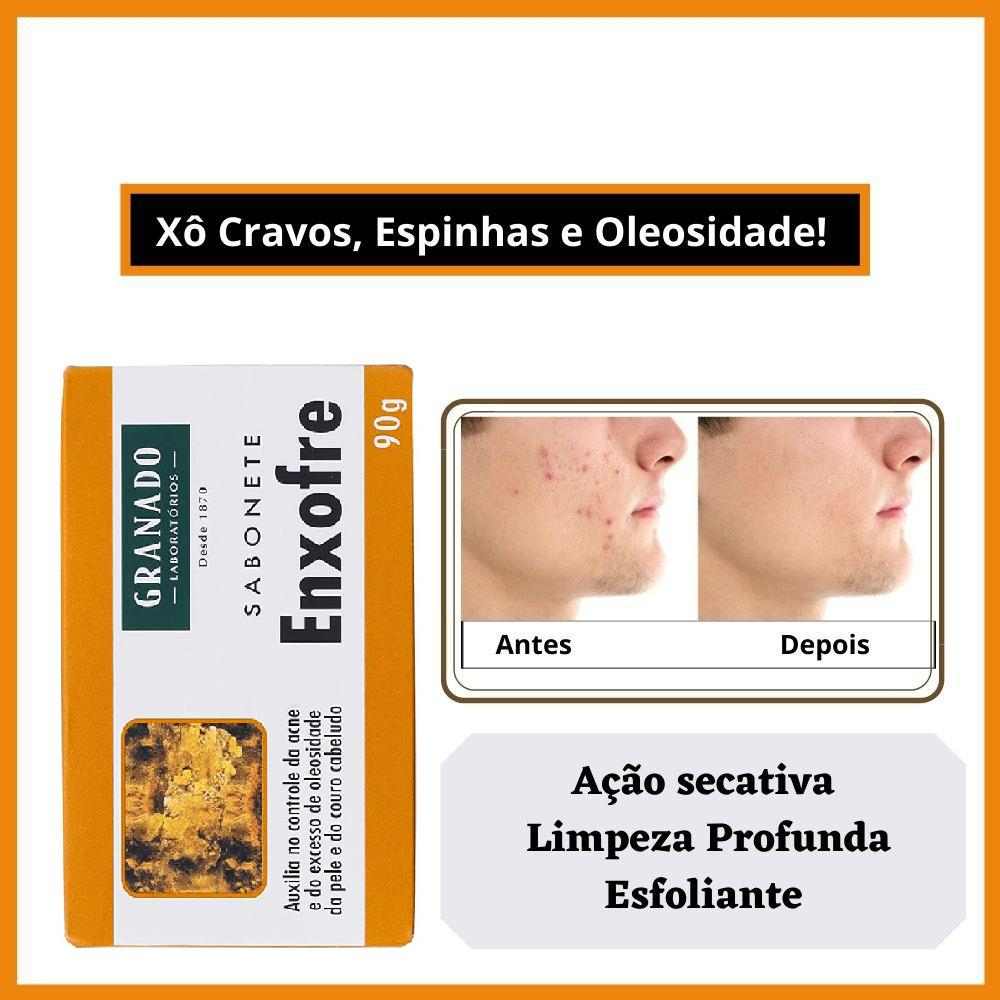 Sabonete Granado Antiacne Pele Oleosa com Cravos e Espinhas Ação Secativa com Enxofre e Ácido Salicílico 90g