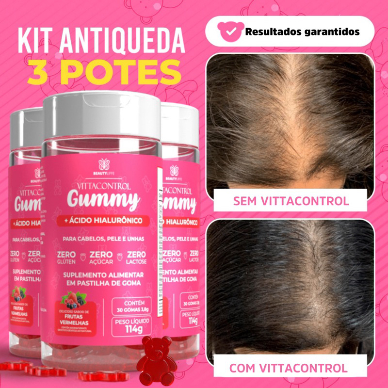 Kit 3 VittaControl Gummy ZERO AÇUCAR - SUPER CONCENTRADO - 1 goma ao dia para Cabelos, Unhas e Pele