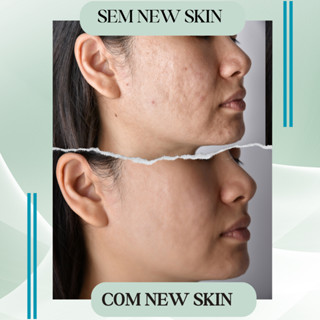 Sérum Facial Hidratante New Skin 10% De Ácido Hialurônico + Vitamina B5 + E