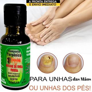 reparo natural de unhas com fungos melaeuca - cravo- e tomilho/ para unhas quebradiças 100% natural - tomilho-fortalecimento