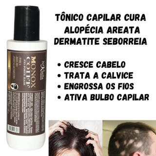 Tratamento Capilar Tonico Anti Alopecia Areata