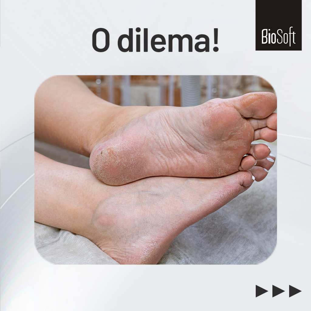 Detalhes do Creme Hidratante Lisa Pé Diabetic