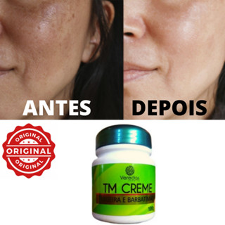 Creme Clareador De Manchas Faciais, Sardas, Melasma, Sol & Seca Espinhas Original