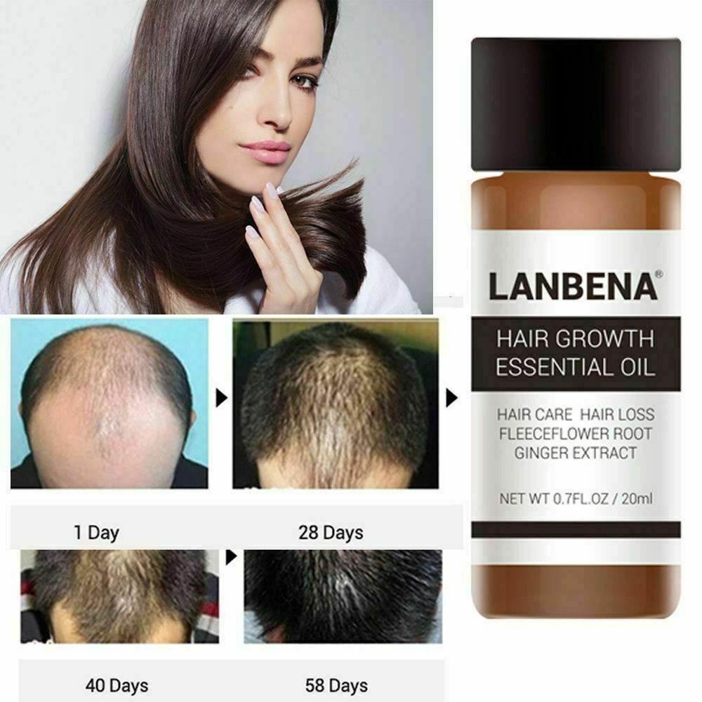 Óleo Essencial Lanbena Poderoso Tratamento Natural para Queda de Cabelo Crescimento Rápido do Cabelo 30  ml