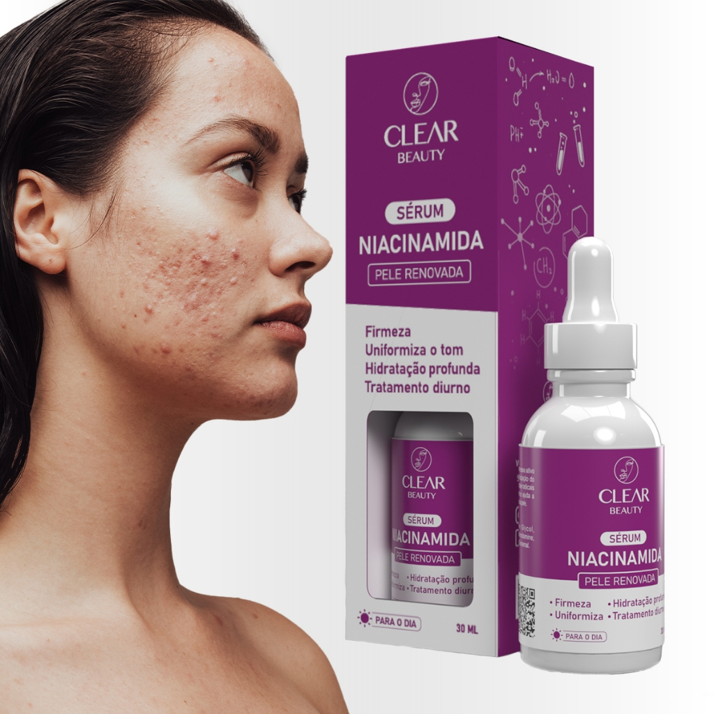 Sérum Facial Anti-acne Com Niacinamida Tratamento de Skin Care - Ação Poderosa em Oferta na Shopee