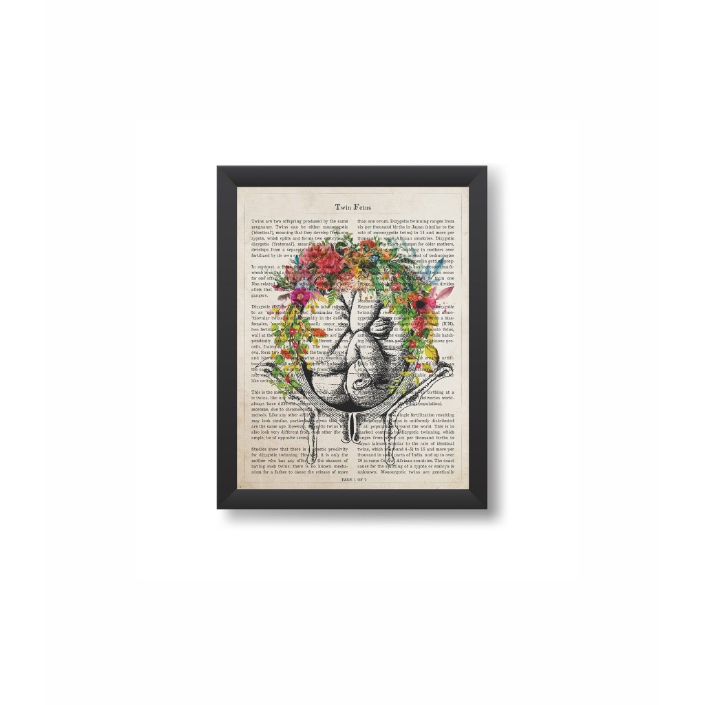 Quadro Decorativo Gestação de Gêmeos Obstetrícia Medicina Moldura 20x30cm Madeira Vidro Cor Preta
