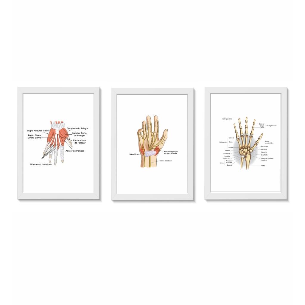 Kit 3 Quadros Decorativos Anatomia da Mão Decoração Consultório Médico Ortopedia e Fisioterapia Molduras 20x30cmMadeira