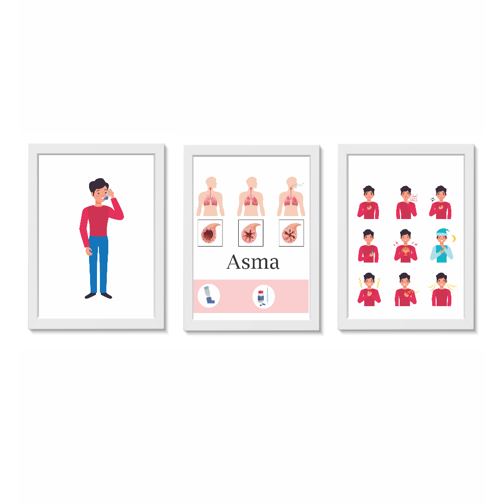 Kit 3 Quadros Decorativos Pneumologia Asma Tamanho 20x30cm Molduras Madeira Vidro Brancas
