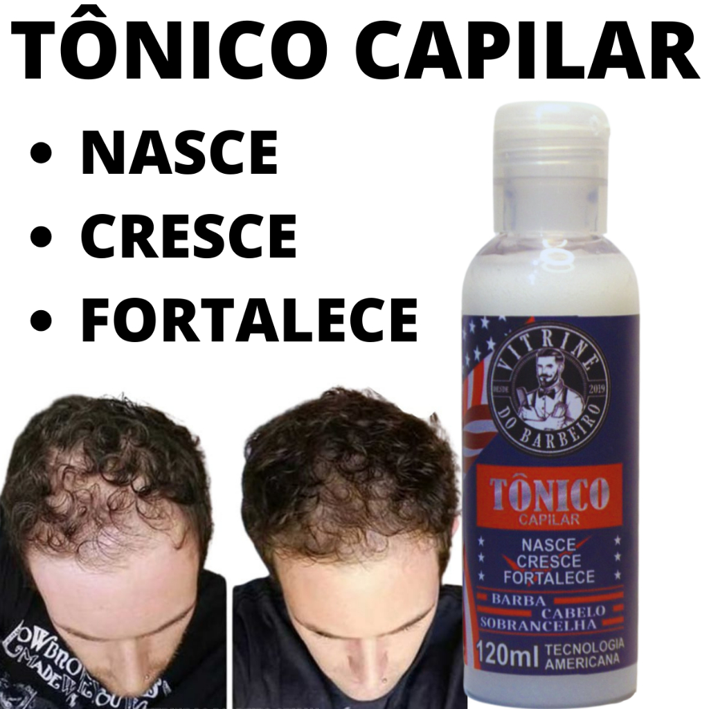 Tônico Revitalizante Para Cabelo Masculino e Feminino