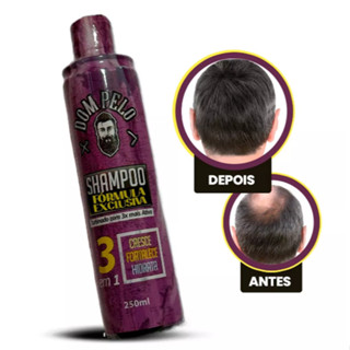 SHAMPOO DOM PELO (3 FUNÇÕES EM 1: CRESCE, FORTALECE E HIDRATA) •LANÇAMENTO em Oferta na Shopee
