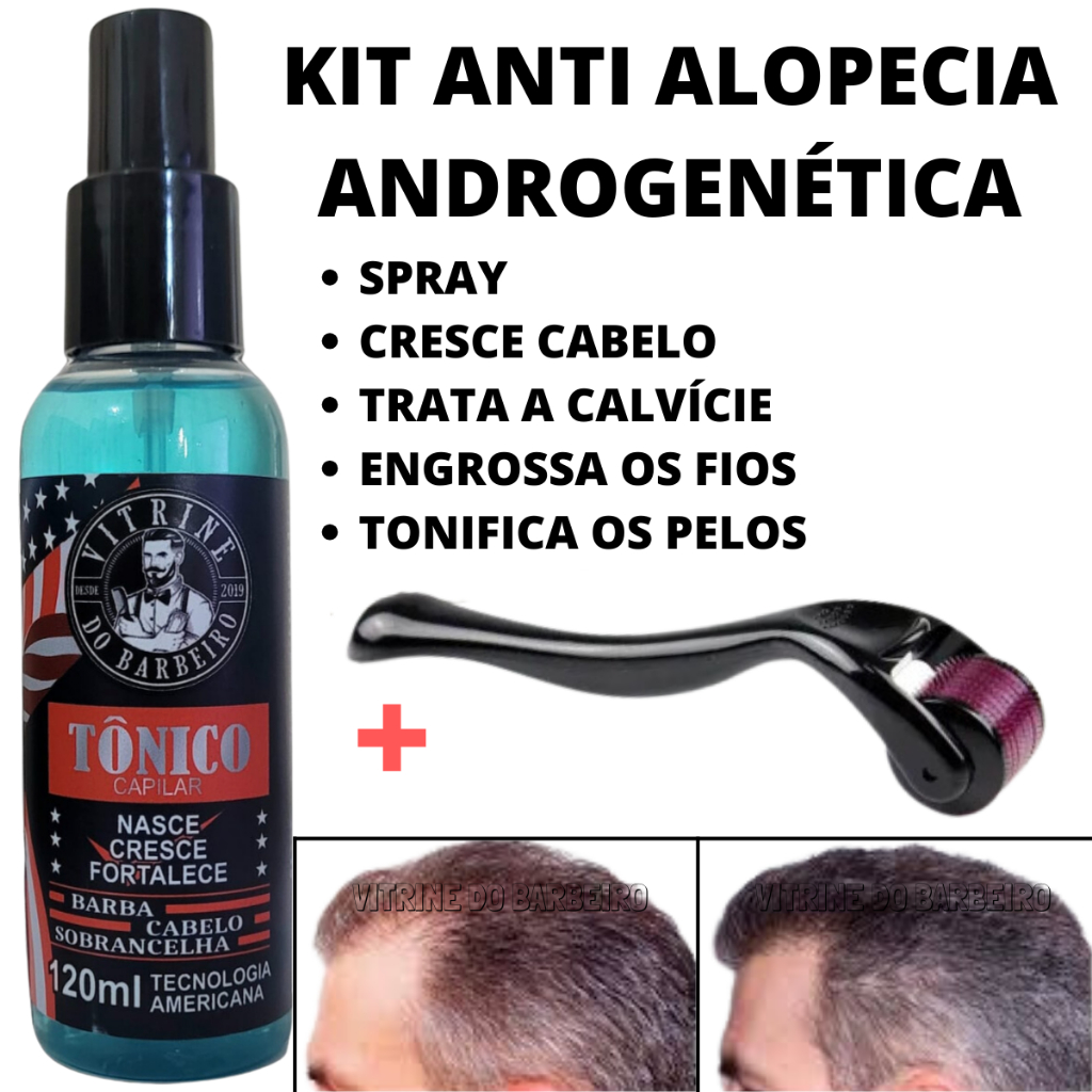 Tônico Capilar + Dermaroller O Melhor Kit Para Cabelo Com Queda Difusa em Oferta na Shopee