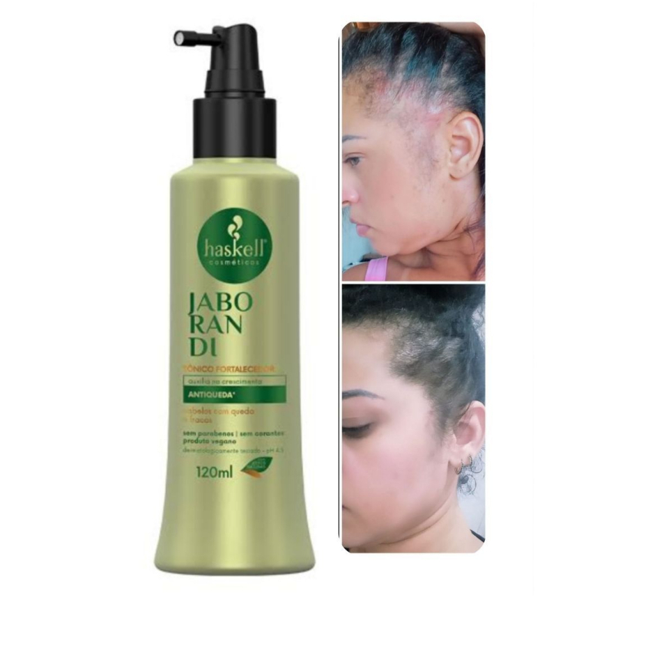 Jaborandi no Cabelo: Onde Comprar | BuscaProdutos