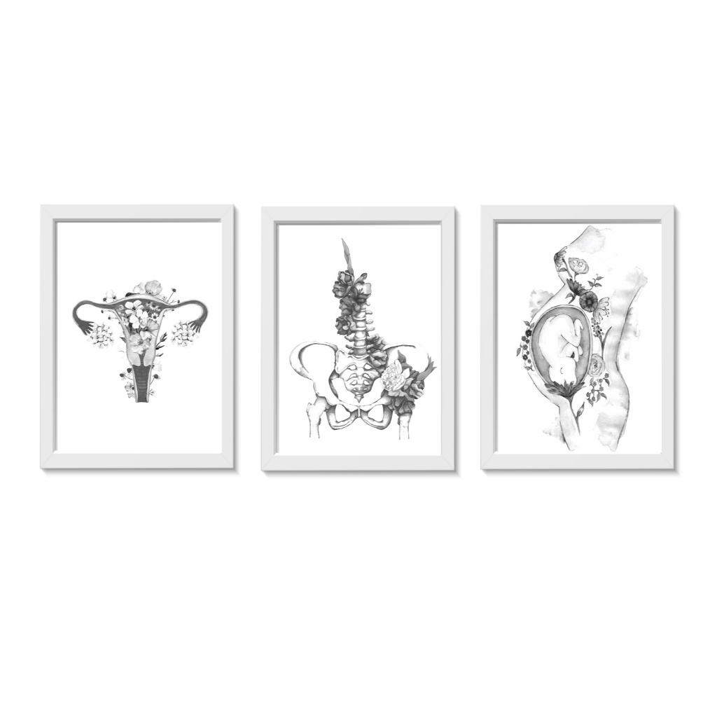 Kit 3 Quadros Útero Pelve Gestante Ginecologia Obstetrícia Medicina Consultório Moldura 20x30cm Madeira