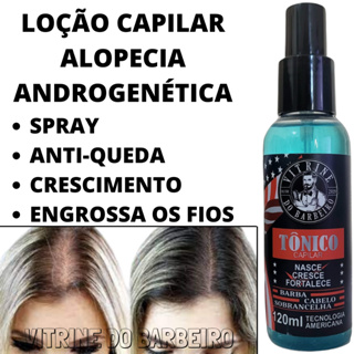 Tônico Capilar Em Spray Para Crescimento e Fortalecimento Do Cabelo em Oferta na Shopee