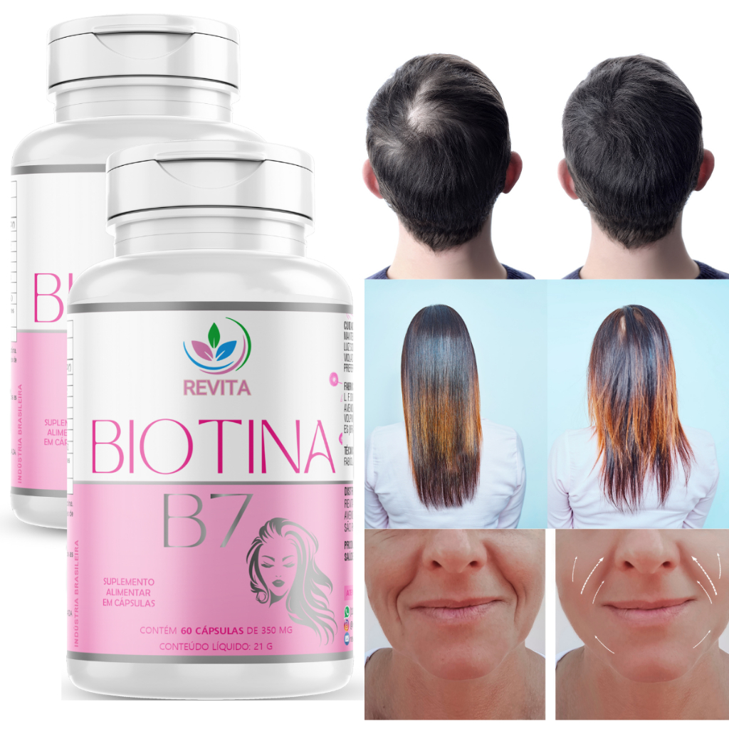 KIT 2 BIOTINA B7 CABELOS PELE UNHA 60 CAPS