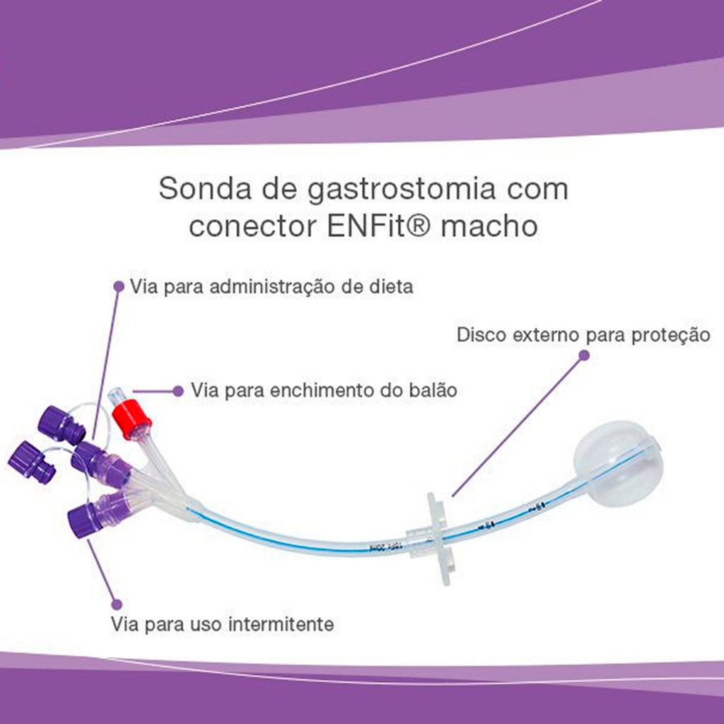 SONDA DE GASTROSTOMIA SISTEMA ENTERAL ENFIT C/ TRAVA 100% SILICONE C/ BALÃO 20ML