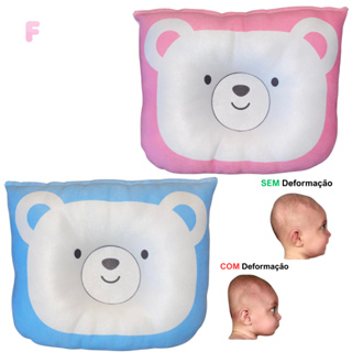 Travesseiro Plagiocefalia Bebê Respirável Hipoalergênico Ortopédico Modelador Anatômico Antiachatame em Oferta na Shopee