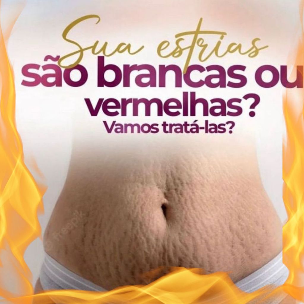 Gel Redutor Potente de Estrias Celulites e Gordura Localizadas Flacidez