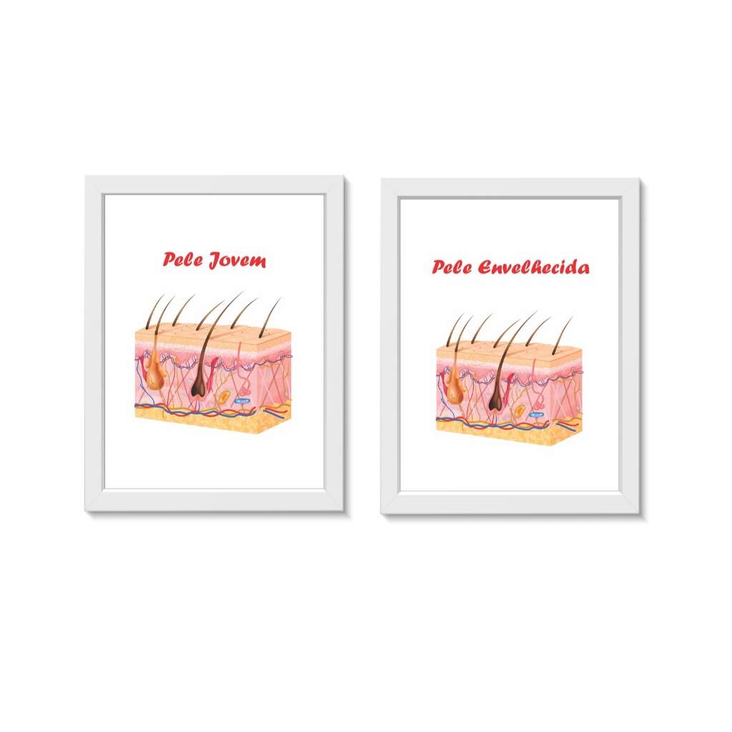 Kit 2 Quadros Decorativos Pele Dermatologia Medicina Molduras 30x40cm Madeira Vidro Brancas