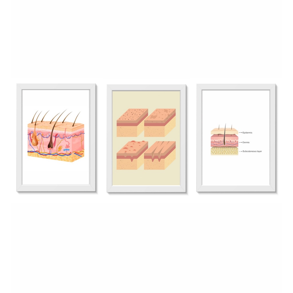 Kit 3 Quadros Decorativos Anatomia da Pele Consultório Decorativo Dermatologia Molduras 20x30cm Madeira