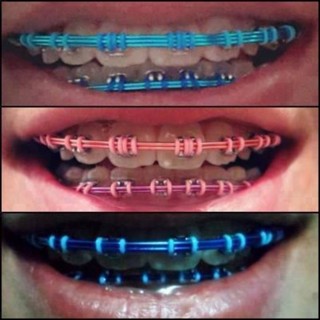 10 Fio Arco Ferrinho Colorido de Aparelho Grossinho (10 unidades) em Oferta na Shopee